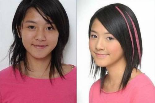 Before & After