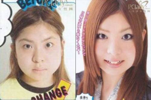 Before & After