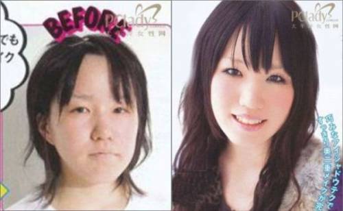 Before & After