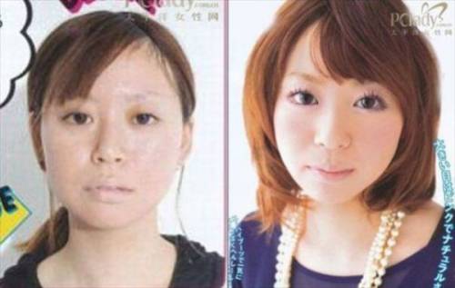 Before & After