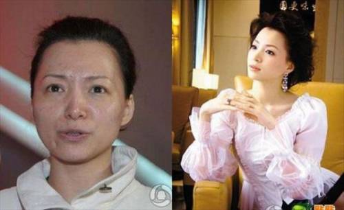 Before & After