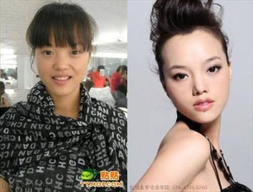 Before & After