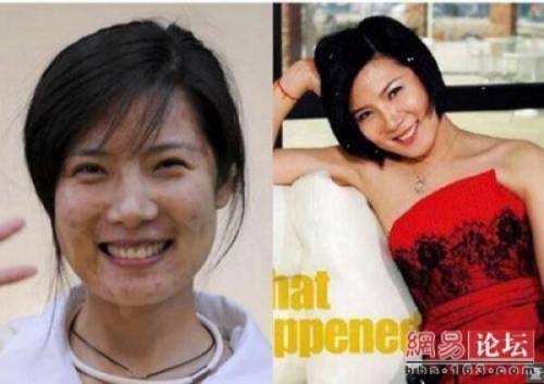Before & After 2