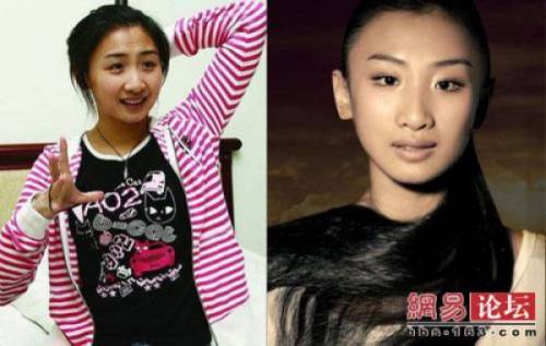 Before & After 2