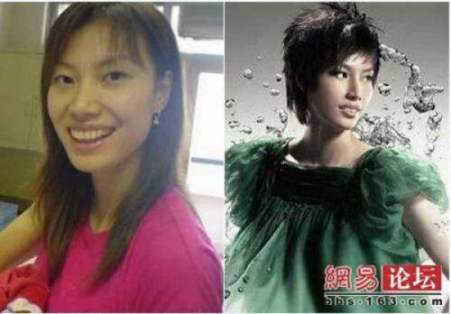Before & After 2