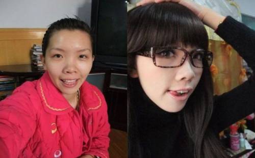 Before & After 3