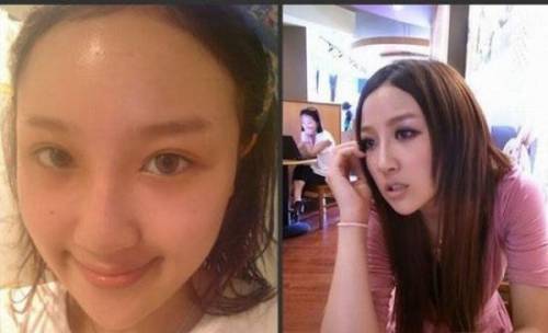 Before & After 3