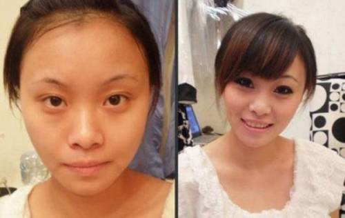 Before & After 3