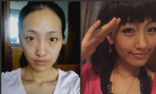 Before & After 3
