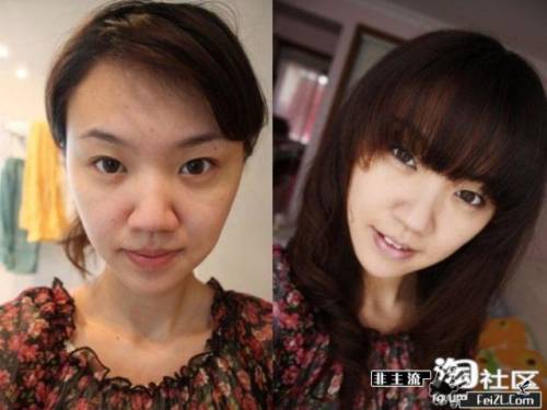 Before & After 3