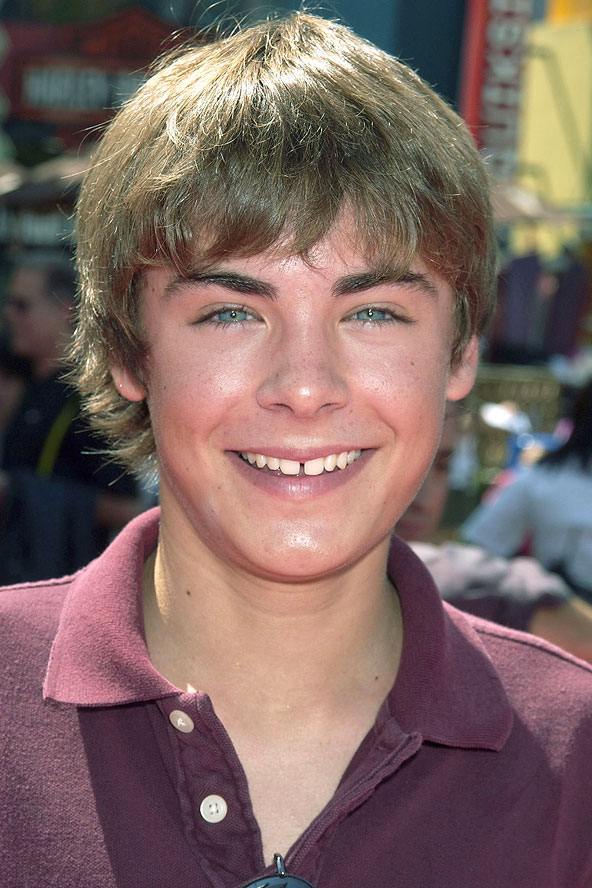 Celebrity Teeth: Before and After