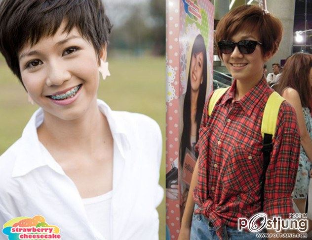 สาวๆก่อนและหลังดัดฟัน