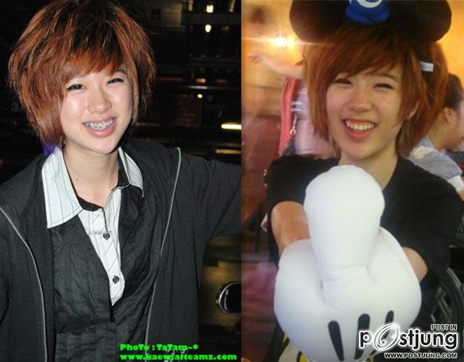 สาวๆก่อนและหลังดัดฟัน