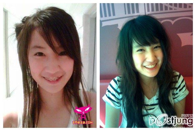สาวๆก่อนและหลังดัดฟัน