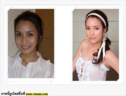 จั๊กจั่น