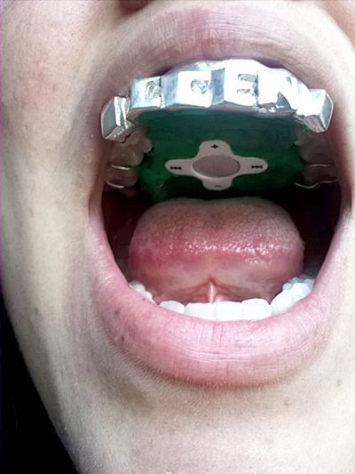 เครื่องเล่น MP3 รุ่นแปลก อยากฟังต้องเอาใส่ปาก