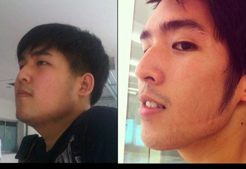 สุดยอดอะ เนย อิทธิมนต์ จากหนุ่มอ้วน เป็นหนุ่มหล่อ
