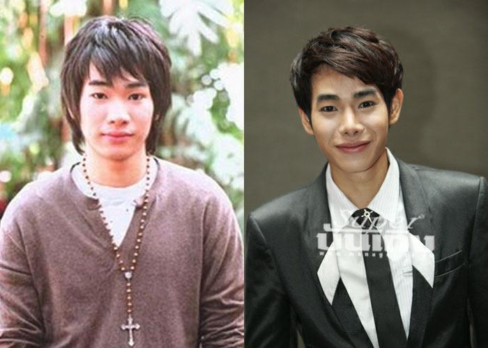 เป๊ก-ผลิตโชค โต้ อัพหน้าเสริมดั้งอีกรอบ แค่ดัดฟัน-ผอมลง