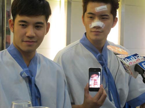 บี้ KPN โดนทำร้าย เย็บ 33 เข็ม