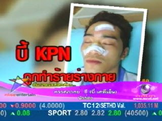 รวมภาพบี้ บอม (ช่วยตามหาคนร้ายด้วยนะครับ)