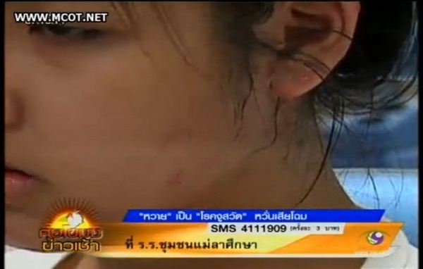 หวิดเสียโฉม'งูสวัด'ขึ้นหน้า'หวาย ปัญริสา'