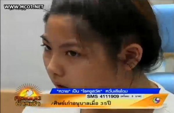 หวายดีใจงูสวัดหายแล้วโล่งไม่เป็นรอยแผล