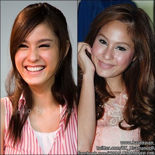 คุณคิดว่าตอนนี้ 'ขวัญ อุษามณี' หน้าบวมขึ้นกว่าแต่ก่อนรึป่าว ?
