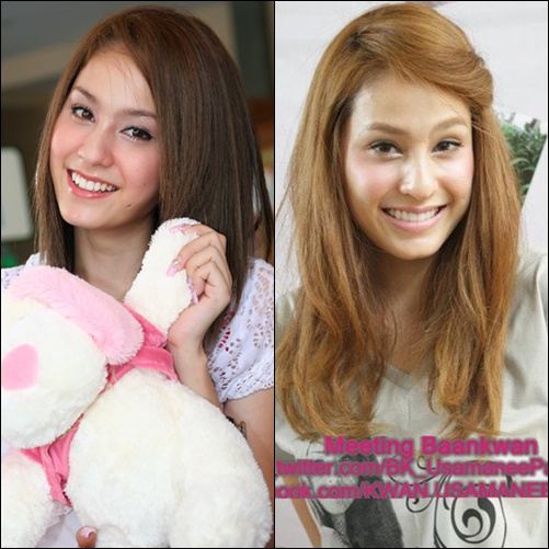 คุณคิดว่าตอนนี้ 'ขวัญ อุษามณี' หน้าบวมขึ้นกว่าแต่ก่อนรึป่าว ?