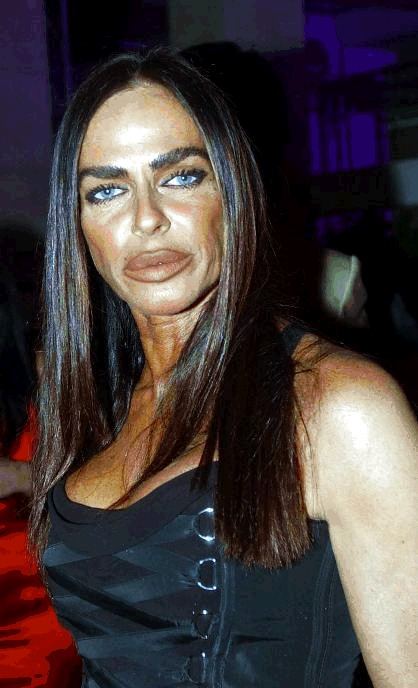 อันดับที่ 10 Michaela Romanini สาวสังคมชาวอิตาลี เธอเป็นผู้มีชื่อเสียงในเรื่องของการฉีดคลอลาเจน