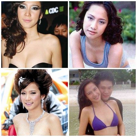 ศัลยกรรมกับวงการบันเทิง