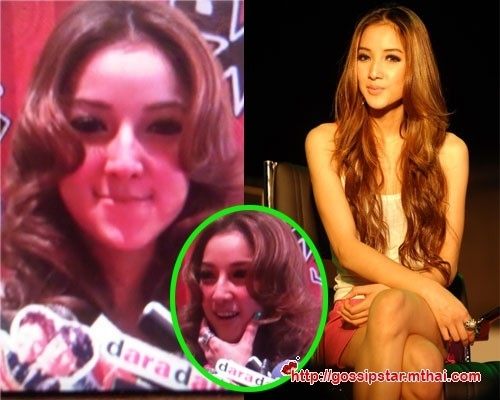 ศัลยกรรมกับวงการบันเทิง