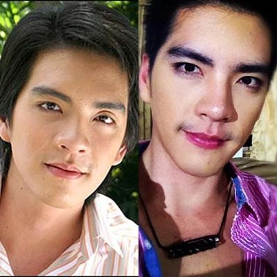 ศัลยกรรมกับวงการบันเทิง