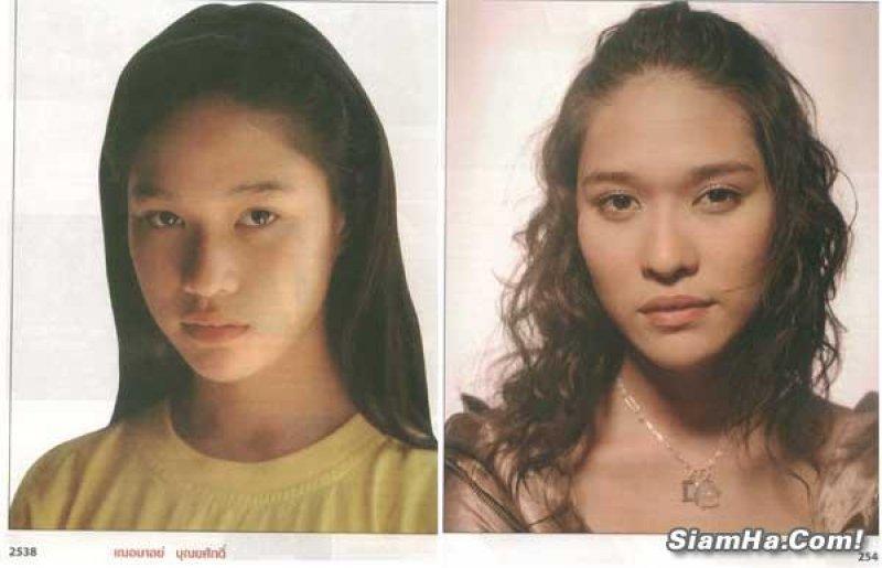 ศัลยกรรมกับวงการบันเทิง