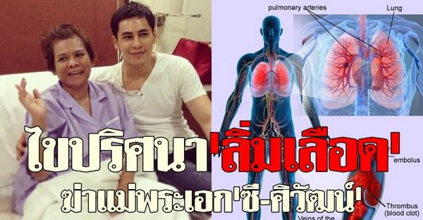 ไขปริศนา'ลิ่มเลือด'ฆ่าแม่พระเอก'ซี-ศิวัฒน์'