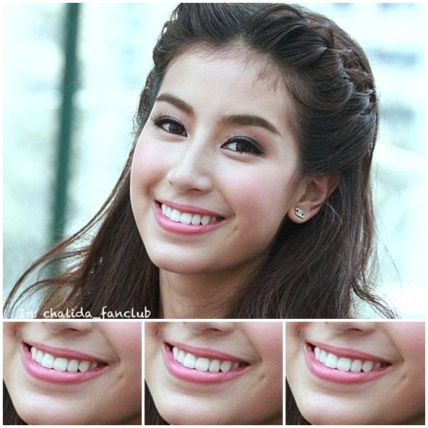 เฉลย ริมฝีปากสวยๆของดารา  กระทู้เมื่อวาน