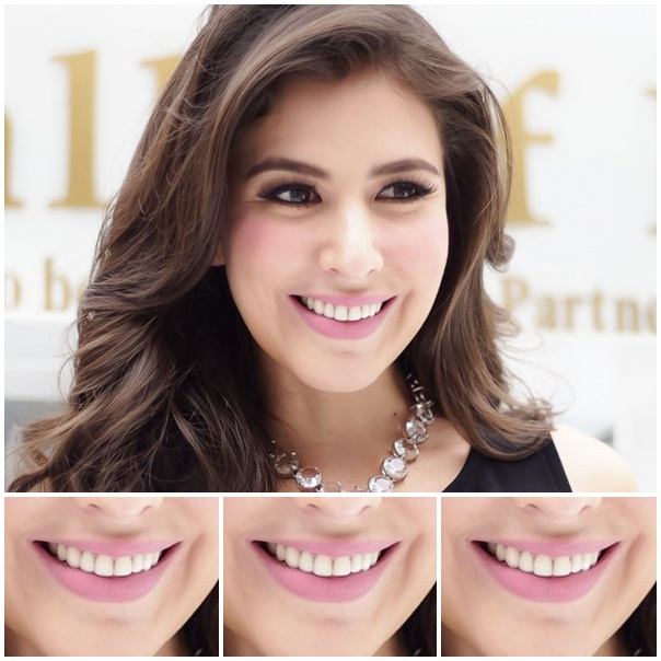 คุณชอบริมฝีปากใครมากที่สุด
