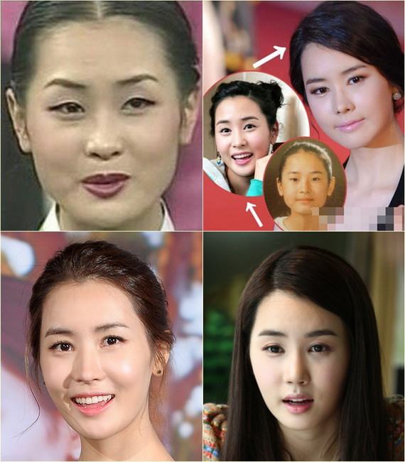 อีดาแฮ  ยอมรับ ทำศัลยกรรมก่อนเข้าวงการ !