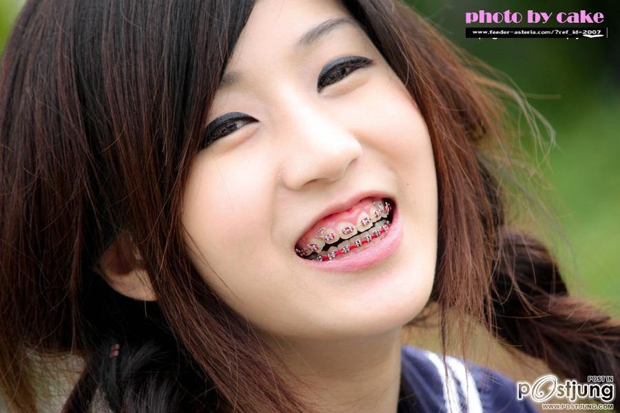 น้องนักเรียนใส่เหล็กดัดฟันน่าร๊ากก