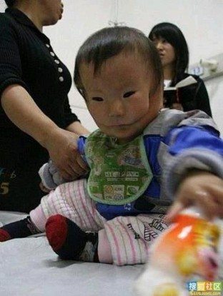 เด็กน้อยน่าสงสาร