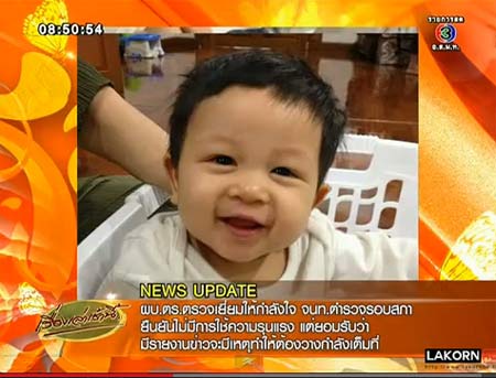 เป้ย - ป๊อป สุดห่วง น้องโปรด เป็นแผลในปากขนาดใหญ่