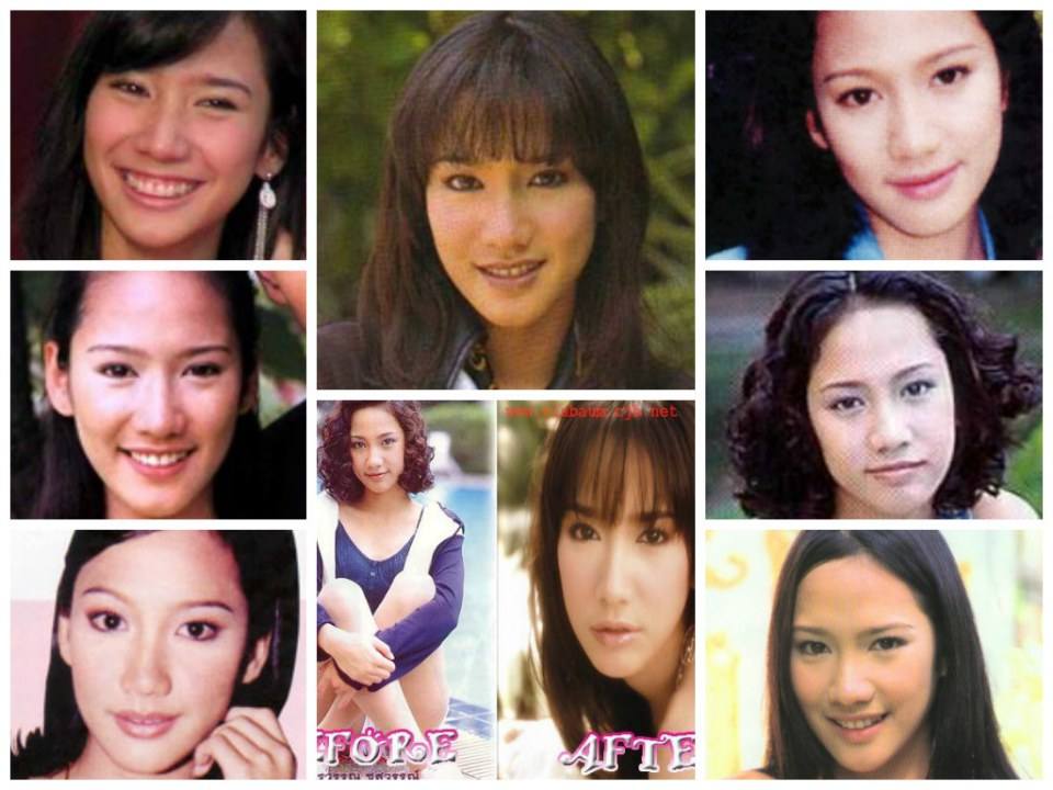 ดารา ไทย ก่อน -- และหลังทำเข้าวงการบันเทิง ดูด่วน_!!!!!!