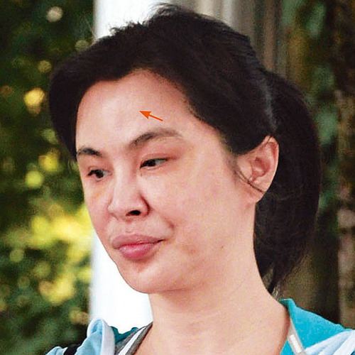 "หวังจู่เสียน" เสียโฉมจากศัลยกรรม??