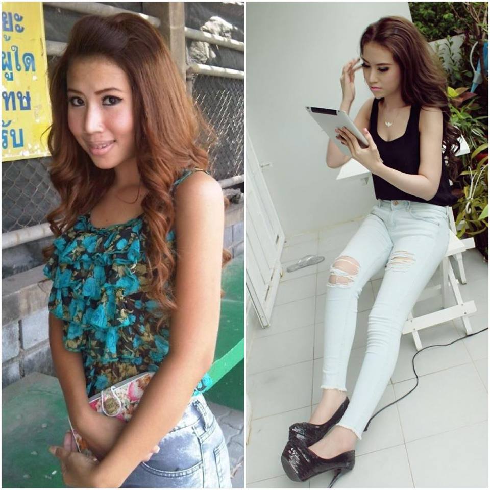 พลอยภัทร์ชา โกสิยวัฒน์ Ploypatcha สวยศัลยกรรมเปลี่ยนชีวิต เปลี่ยนใบหน้า