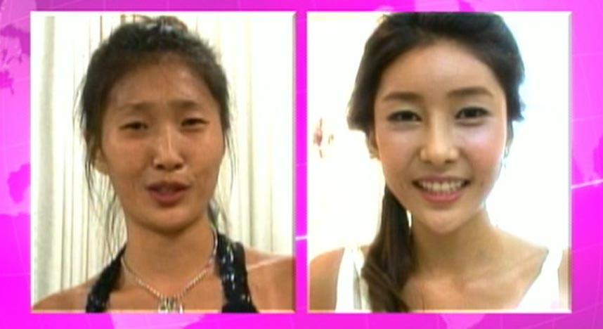ภาพก่อนและหลัง ศัลยกรรม สาวเกาหลี