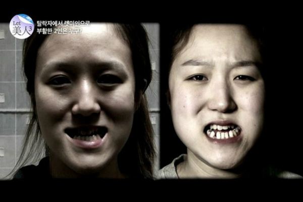 ฮือฮา!รายการเกาหลี จับ ฝาแฝดสุดขี้เหร่ ผ่าตัดหน้าจนสวยขั้นเทพ! เห็นแล้วจะอึ้ง