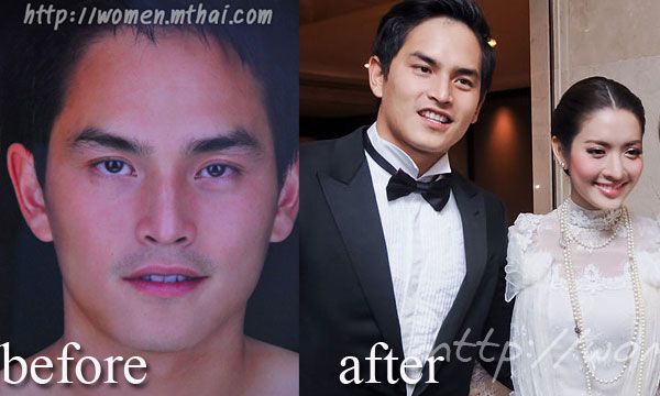 หนุ่มหล่อหน้าเป๊ะ 10ปีไม่มีเปลี่ยน