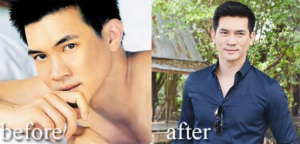 หนุ่มหล่อหน้าเป๊ะ 10ปีไม่มีเปลี่ยน