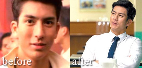 หนุ่มหล่อหน้าเป๊ะ 10ปีไม่มีเปลี่ยน