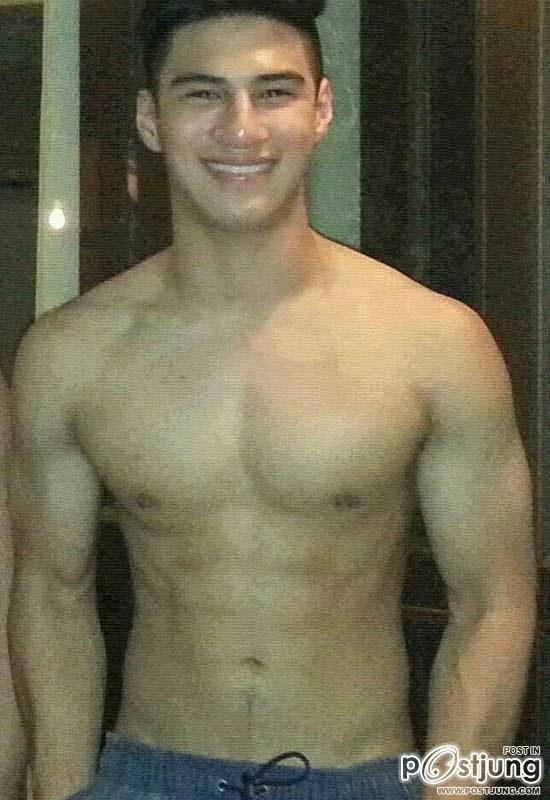 Albie Casino
