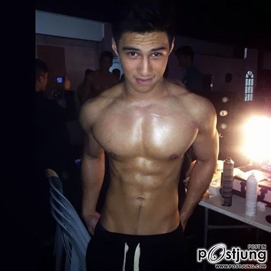 Albie Casino